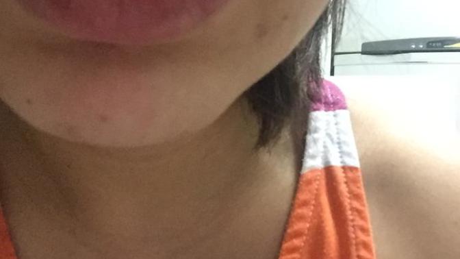 Piercing iltihap kaptı galiba?