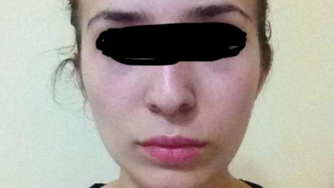 Sizce yüz şeklim bunlardan hangisi? Oval üçgen kare yuvarlak dikdörtgen v. s?