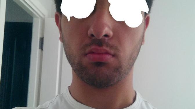 BURNUM VE AĞZIM YAMUK :(?