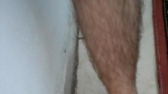 Bacak kılları resimli?