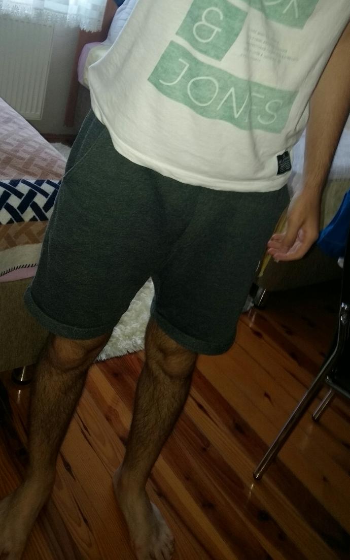 Arkadaşlar bacak kıllarımı hiç aldırmadım ve malum yaz ayı bu şekilde dışarı çıkmaya utanıyorum ne yapmalıyım sizce ?