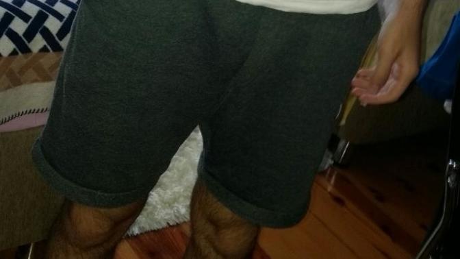 Arkadaşlar bacak kıllarımı hiç aldırmadım ve malum yaz ayı bu şekilde dışarı çıkmaya utanıyorum ne yapmalıyım sizce?