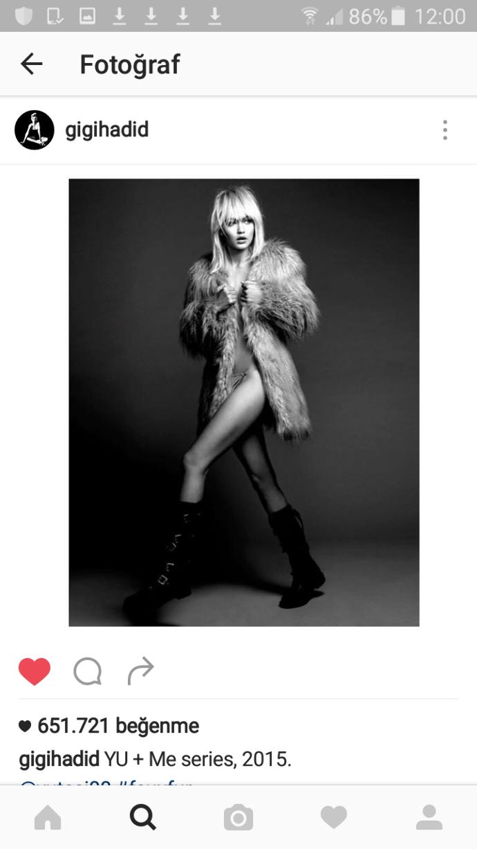 Sizce Gigi Hadid Biraz Killolu mu 👍👎?