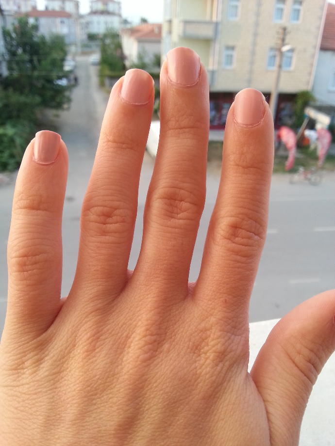 El parmaklarım neden yamuk? 