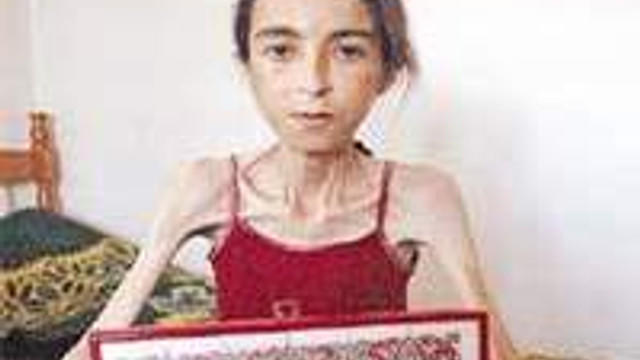 kusma diyeti yapan hatice
