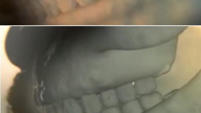 20 lik dişler hakkında bunu biliyor muydunuz?