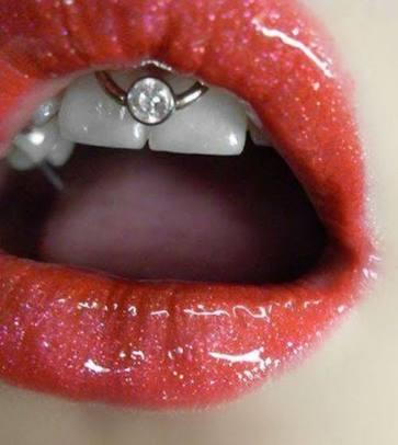Dil piercing mi smiley piercing mi?