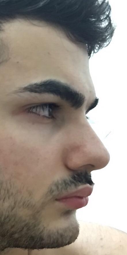 Benim dudaklarım neden öne doğru çıkık ya?