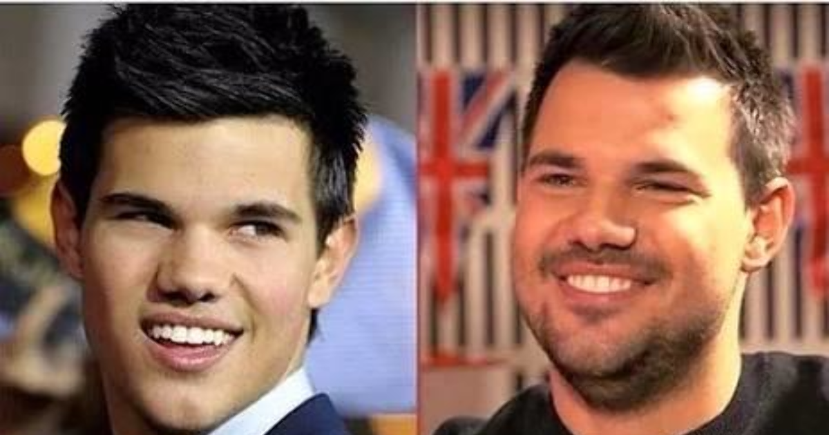 Taylor lautner son hali ? KizlarSoruyor