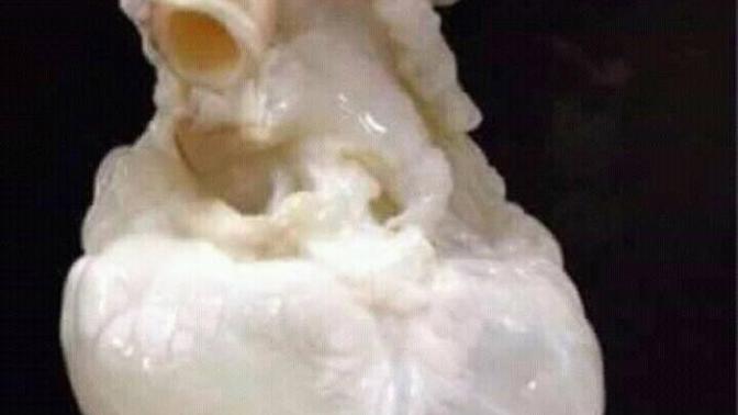 Kanı temizlenmiş kalp gördünüz mü hiç?