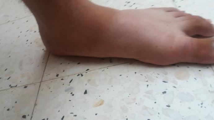 DÜZ tabanmıyım ?