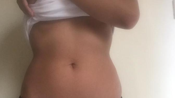 Sizce belimde  bir  yamukluk var mı? (Fotoğraflı)?