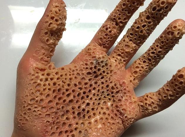 Bu fotoğraflara bakıp çok rahatsız oluyorsanız sizde de tiripofobi var demektir ?