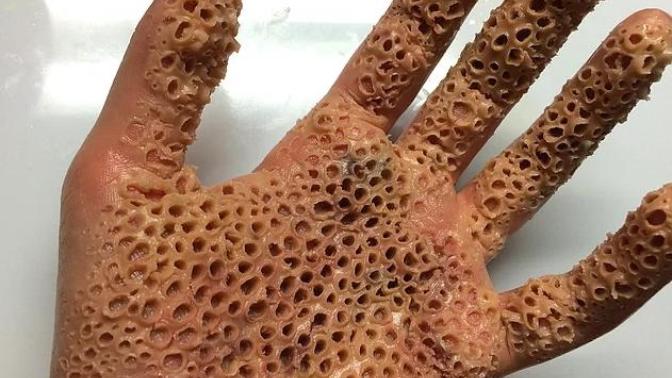 Bu fotoğraflara bakıp çok rahatsız oluyorsanız sizde de tiripofobi var demektir?