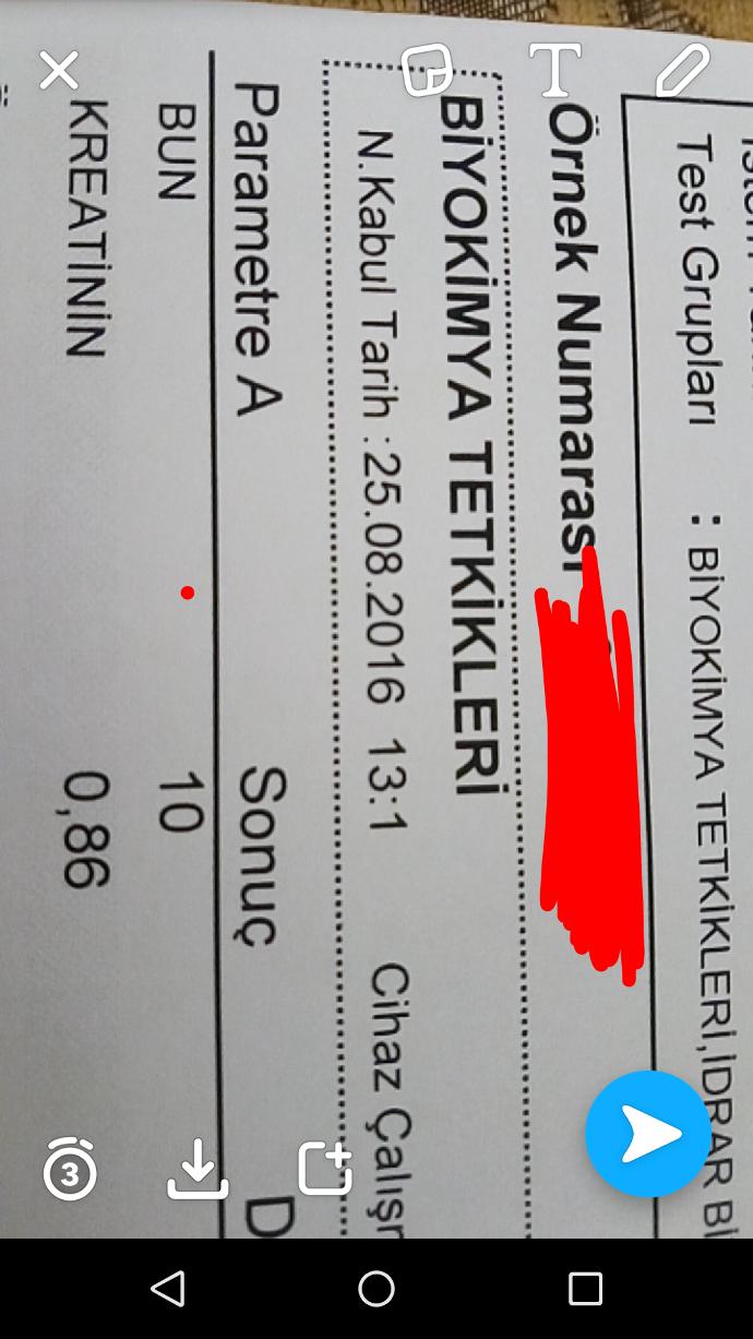Kandaki keratin?