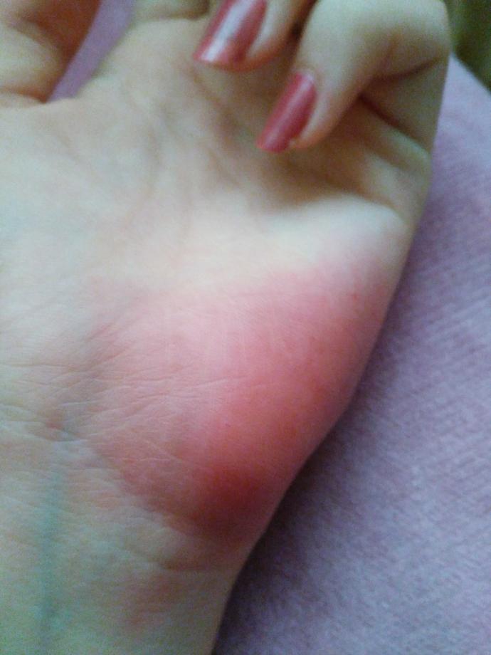 nişanlimla kavga ettik elimi mortatti gidip darp roporu alsam sizce verirler mi??