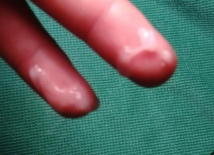 Erkekler, dun masturbasyon yaptim ama bugun bosalmisim gibi bugun bunun gelmesi normal mi ?