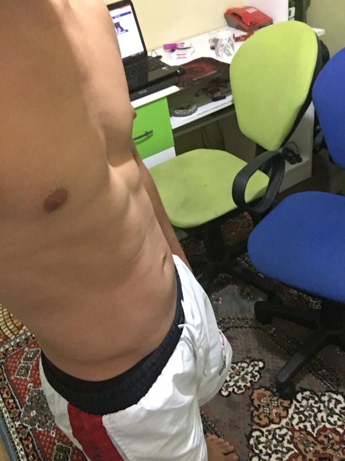Göbeğim neyden olabilir?