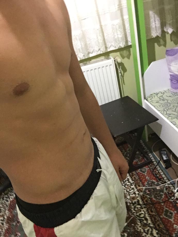 Göbeğim neyden olabilir?