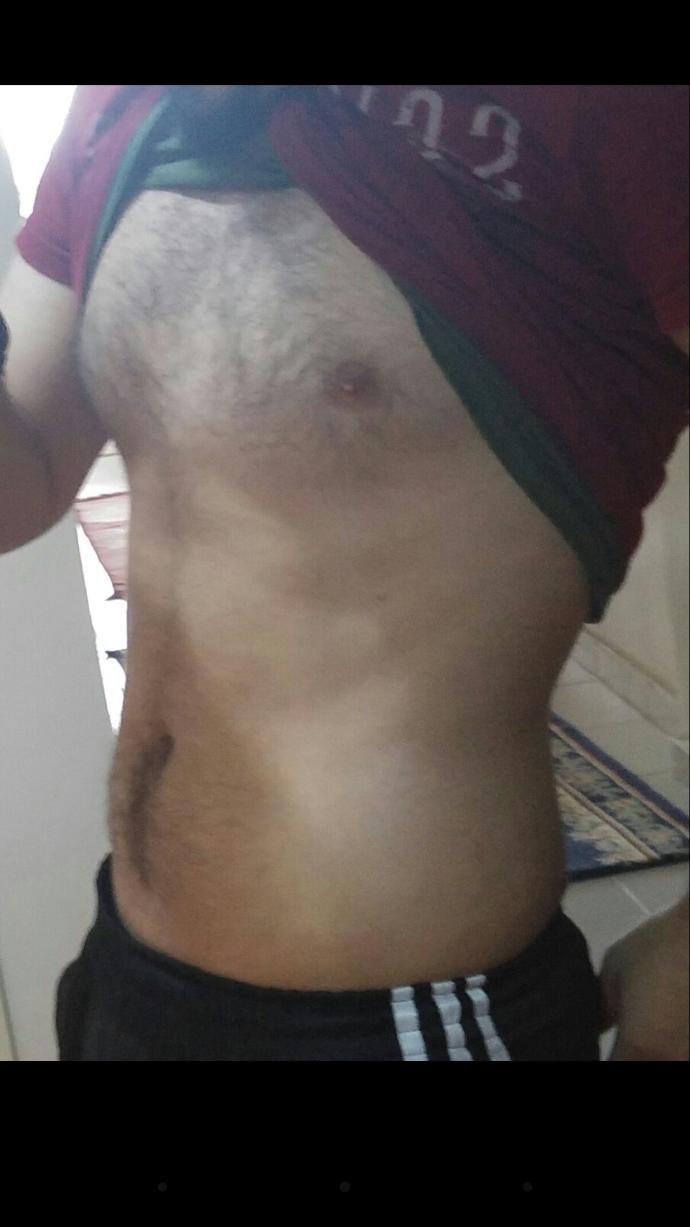 Bel cevresi nasil erir ?