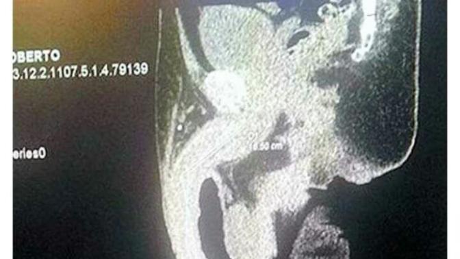 48 cm lik penis?