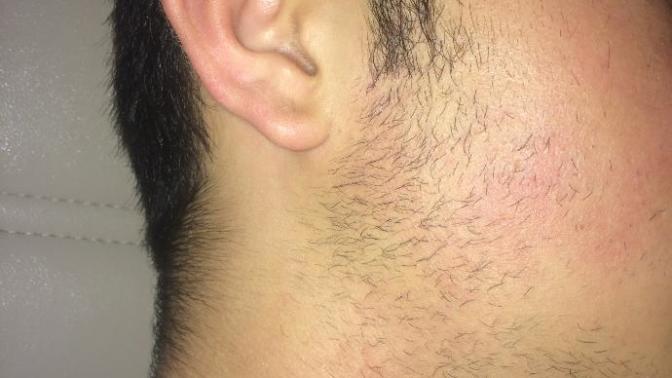 Sakalım ters çıkıyor yardımcı olur musunuz?