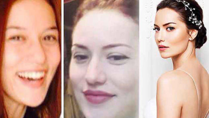 Fahriye Evcen'in estetiksiz hali de güzel mi?