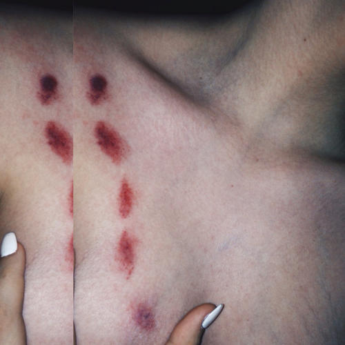 Kızlar, Sevgilinize hickey yapar mısınız?