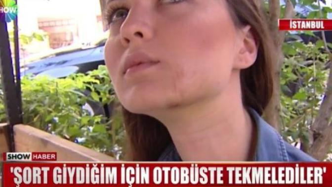 Şort giydiği için otobüste tekme yiyen Ayşegül Terzi haberi hakkında ne düşünüyorsunuz?
