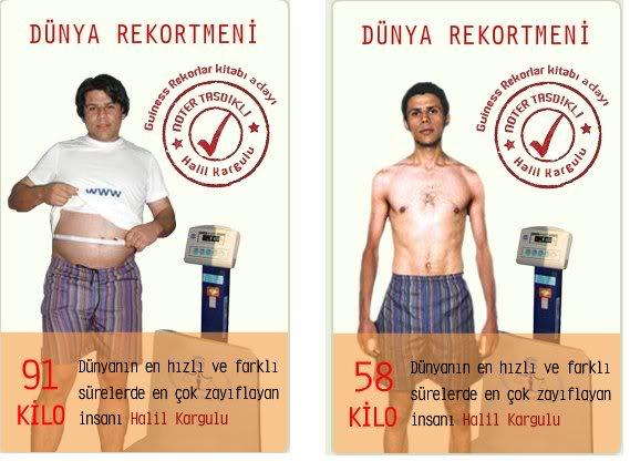 1 günde 7 , 10 günde 15 kilo vermek mümkün mü?