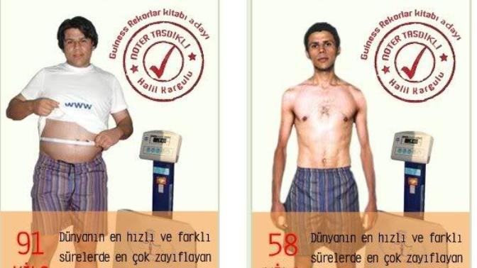 1 günde 7 , 10 günde 15 kilo vermek mümkün mü?