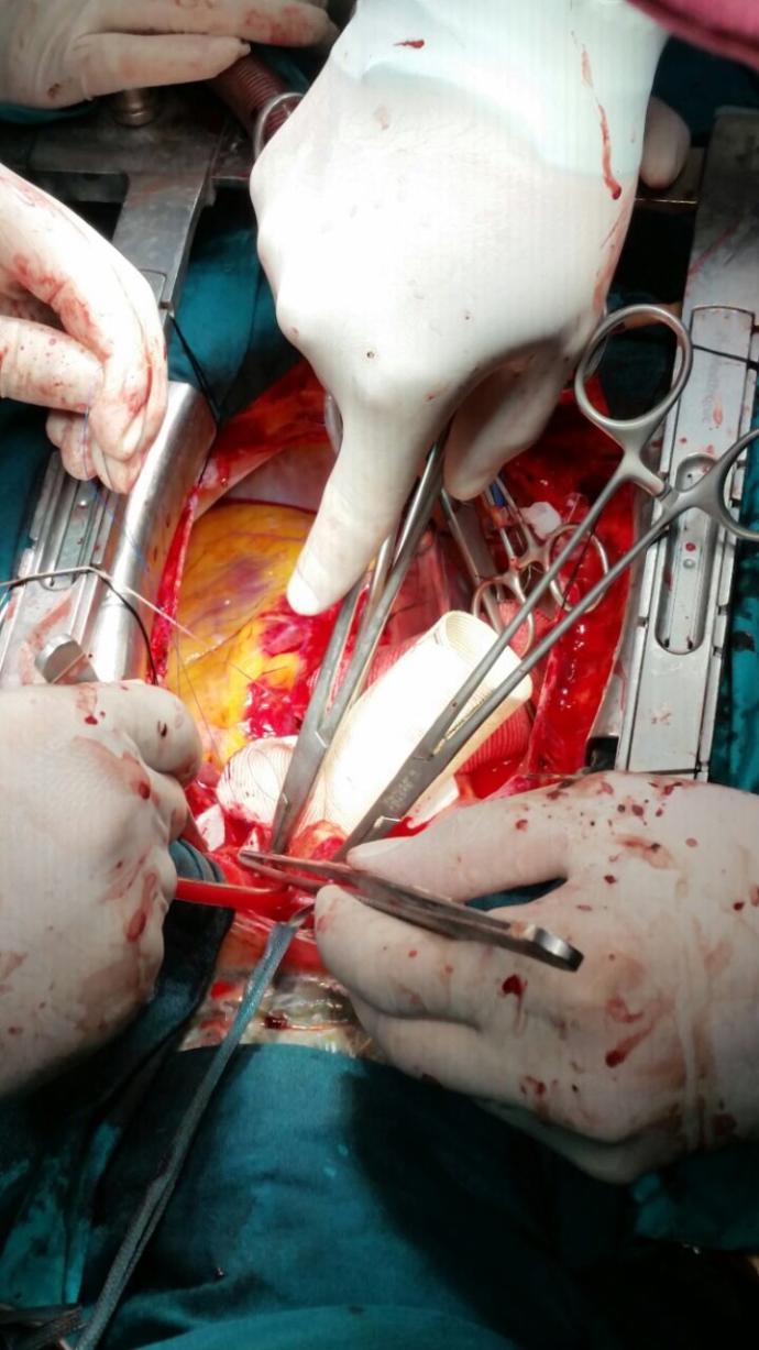 Kalp Ve Damar Cerrahisi?