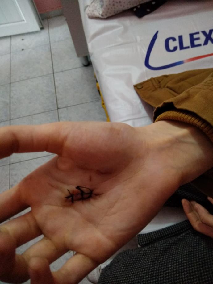 Avuçta bardak kırmak?