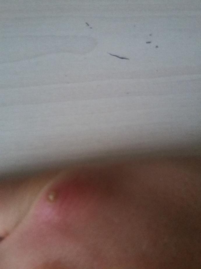 Elimde böyle bir yara çıktı bakar misiniz ?