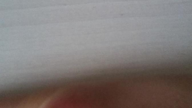 Elimde böyle bir yara çıktı bakar misiniz?