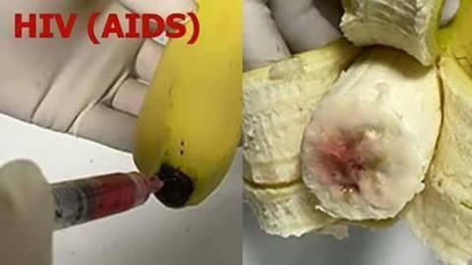 Yurt dışından gelen muzlara AIDS hastalarının kanlarını enjekte ediyorlarmış, sizce doğru mu?