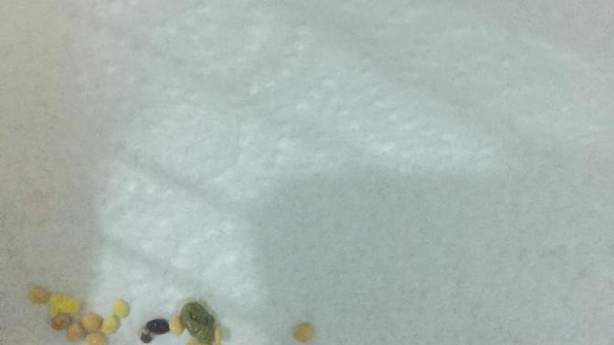 Arkadaşlar kuşumun dışkısı açık yeşil yardım?
