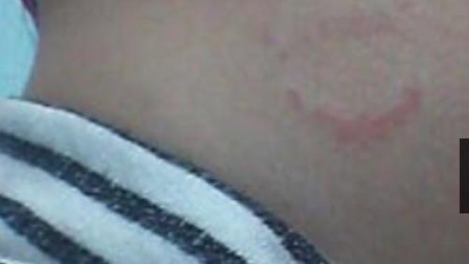 Sevgilim  seks sırasında çok sert davranıyor bana bugun beni isirdı fotoda sizce normal mi?