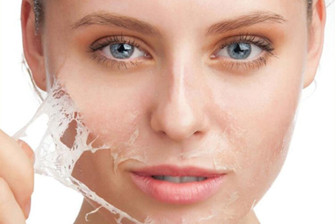 Ostwint peeling jel kullananlar var mı? Kullanıcı yorumları nasıl?