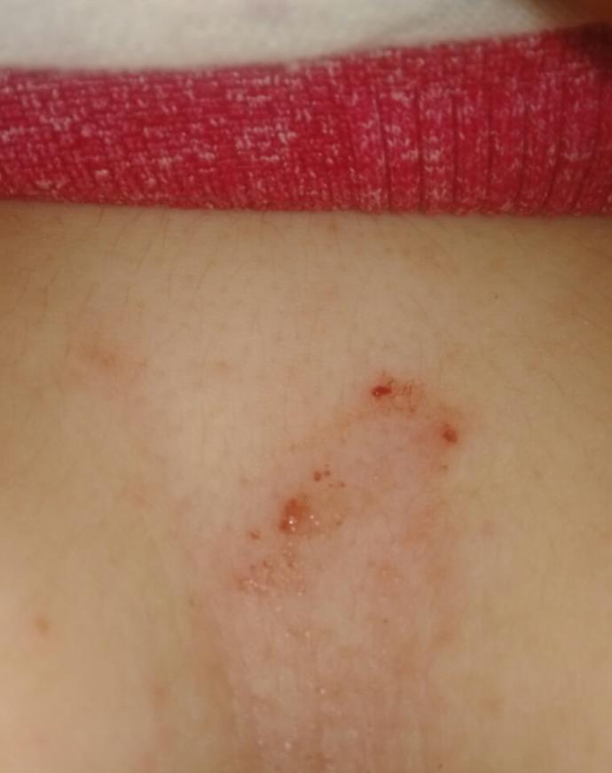 Cok canim aciyor yatinca hissettim neden olmus olabilir bu ?