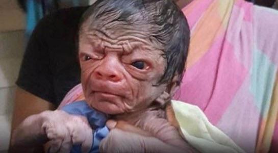 Benjamin Button gerçek oldu! Yaşlı görünüm ile doğan bebeği gördünüz mü?
