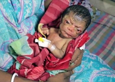 Benjamin Button gerçek oldu! Yaşlı görünüm ile doğan bebeği gördünüz mü?