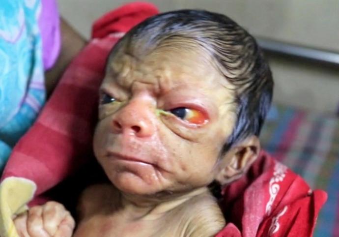 Benjamin Button gerçek oldu! Yaşlı görünüm ile doğan bebeği gördünüz mü?