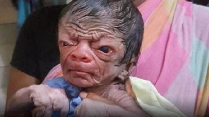 Benjamin Button gerçek oldu! Yaşlı görünüm ile doğan bebeği gördünüz mü?