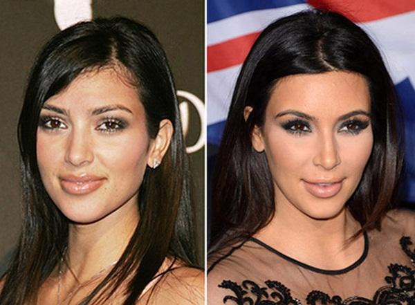 Dünya'nın En İtici Ünlü İsmi: Kim Kardashian Nasıl Ünlü Oldu?...Siz Ne Düşünüyorsunuz?