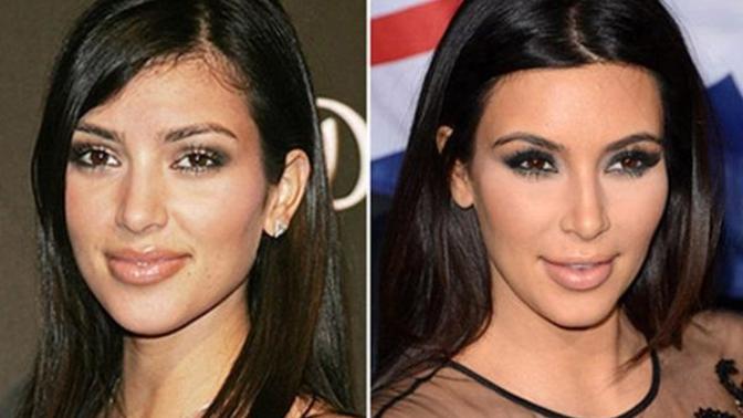Dünya'nın En İtici Ünlü İsmi: Kim Kardashian Nasıl Ünlü Oldu? Siz Ne Düşünüyorsunuz?
