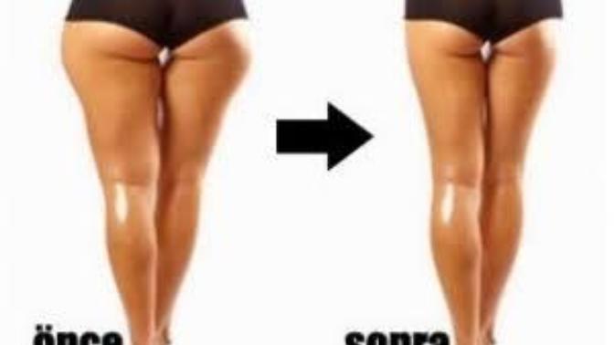 Kalça erimeden nasıl kilo verilir?