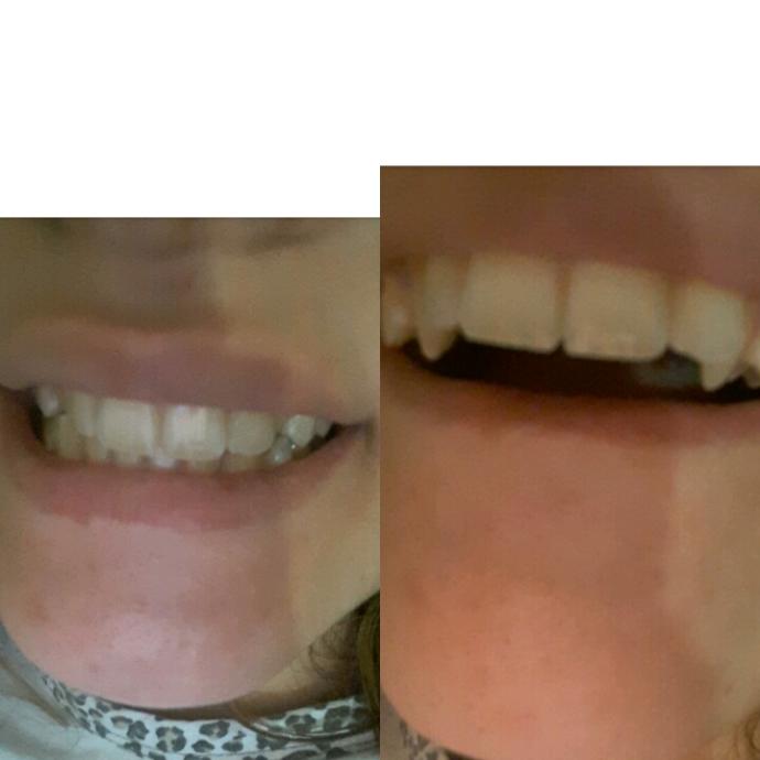 Dislerimi hic begenmiyorum sizce cok mu kotu?