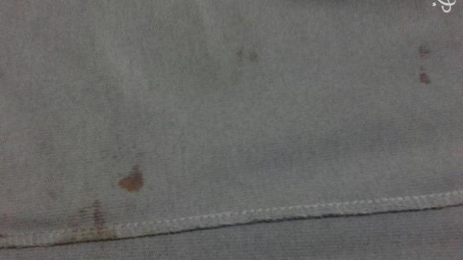 Kurumuş kan lekesi nasıl çıkar ⇩?