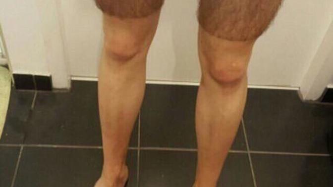 Bu bir kadın bacağı olabilirmi?
